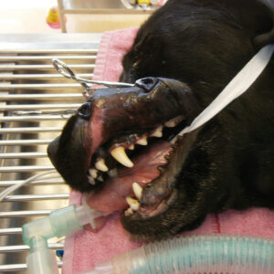 Lip Retractor