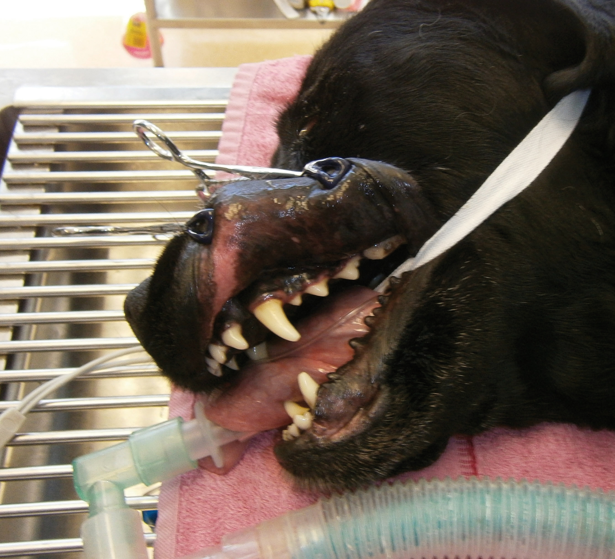 Lip Retractor