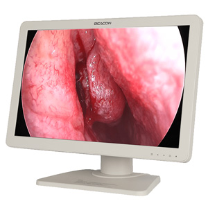 MINDRAY 24" Full-HD display