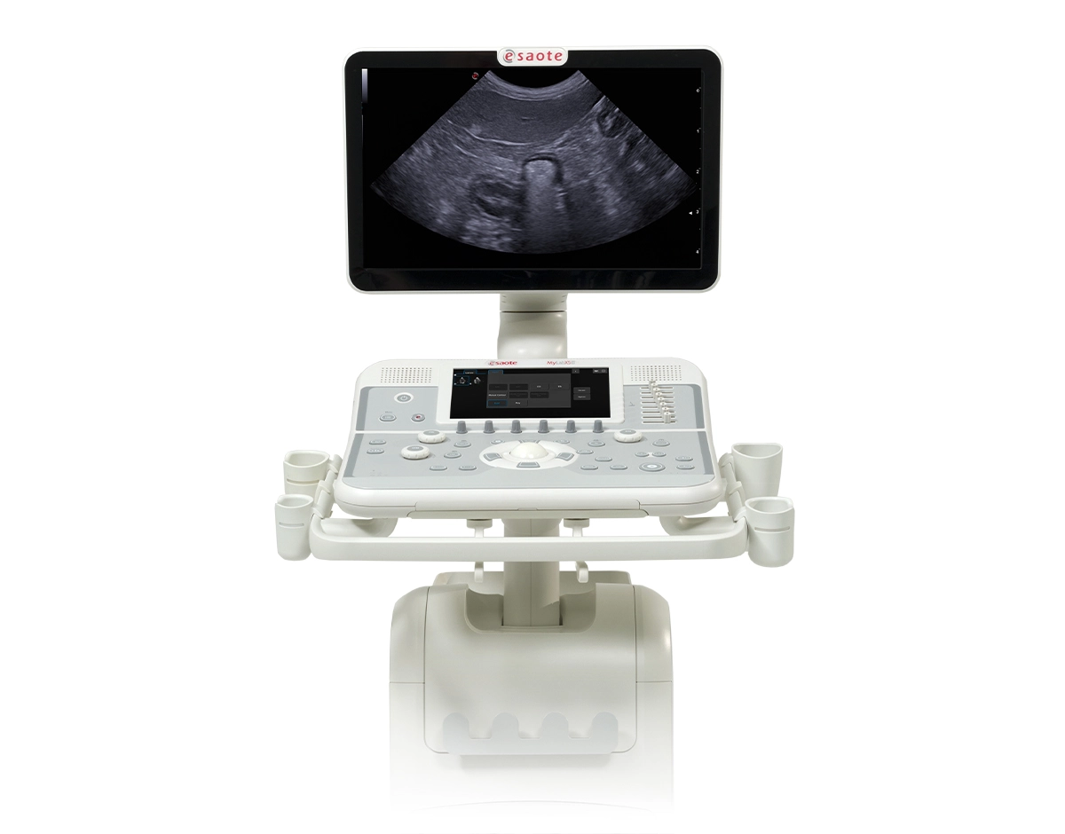 Esaote MyLab X5 - Afbeelding 4