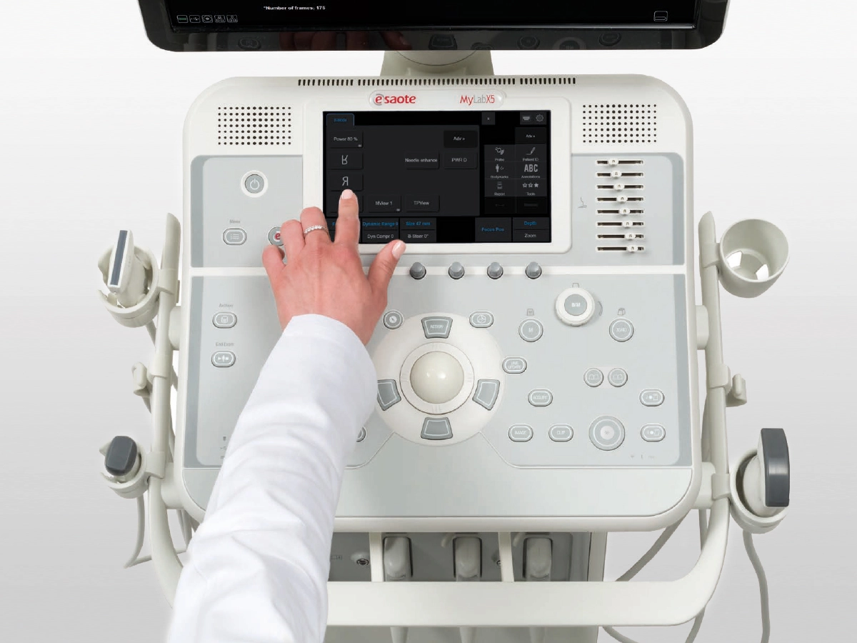Esaote MyLab X5 - Afbeelding 2