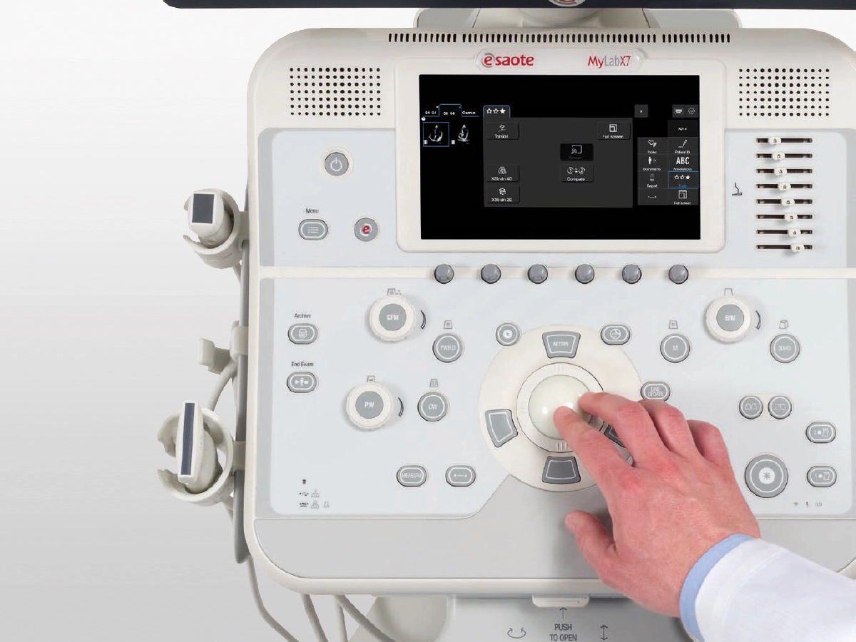 Esaote MyLab X7 - Afbeelding 2